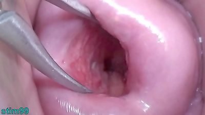 japanese wifey Open Cervix wide to watch inside Uterus